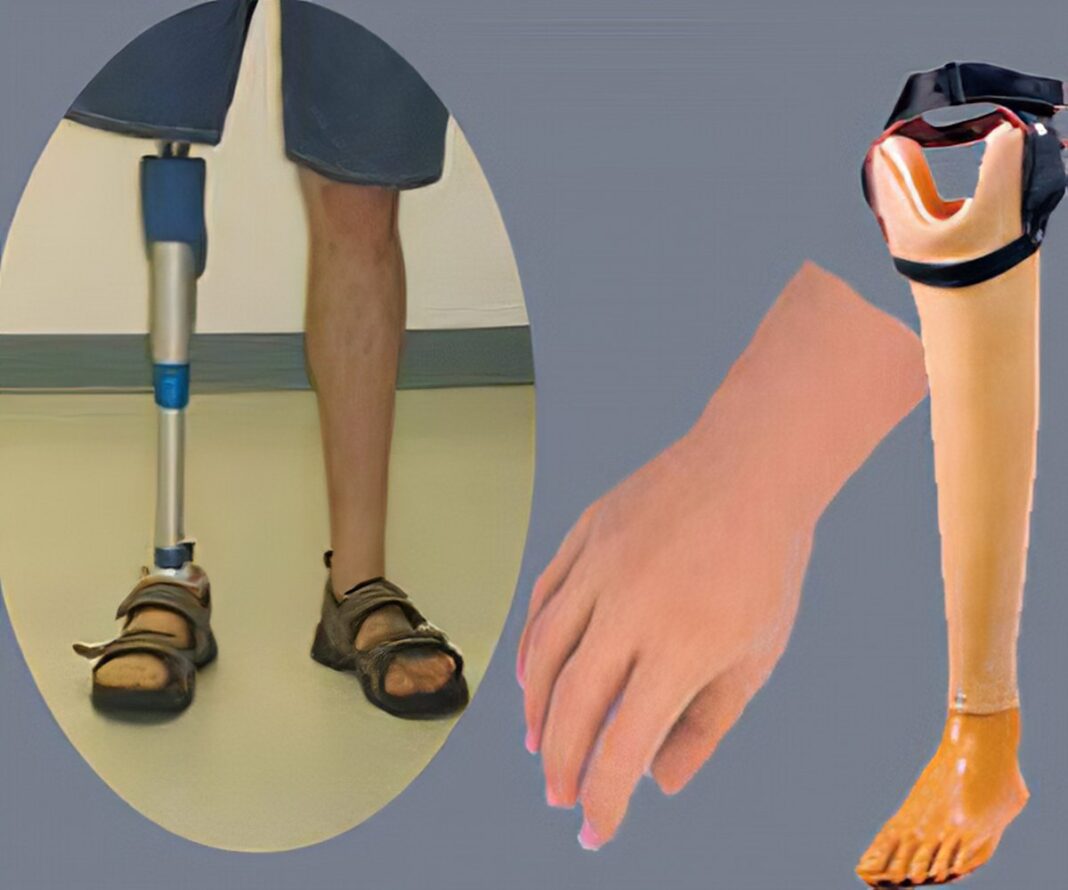 artificial-limbs